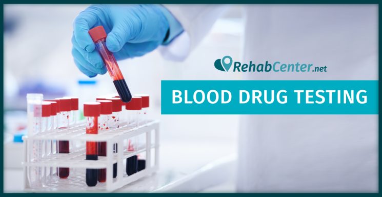 Blood Drug Testing